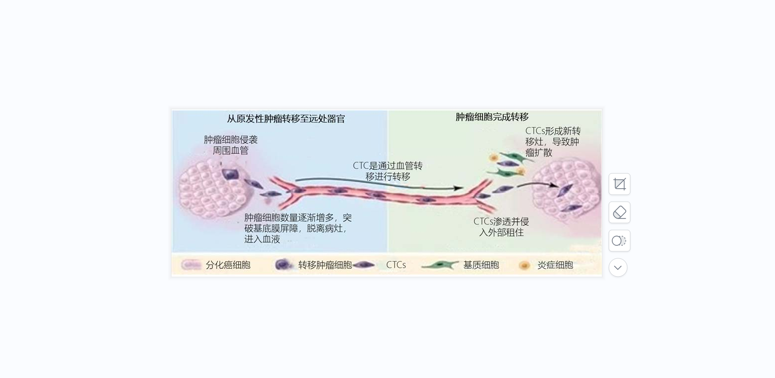 循環(huán)腫瘤細胞（CTC）簡讀